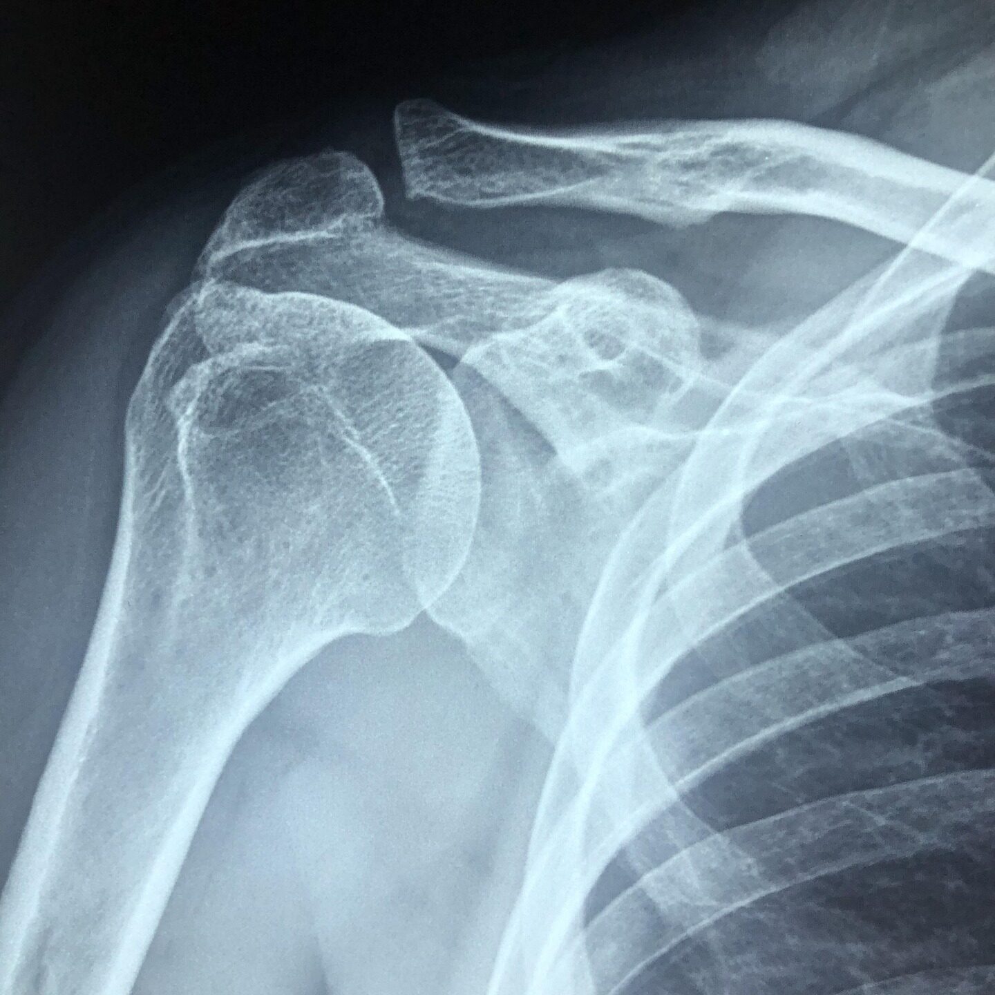 arm 4813365 1920